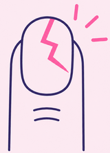 Un ongle cassé